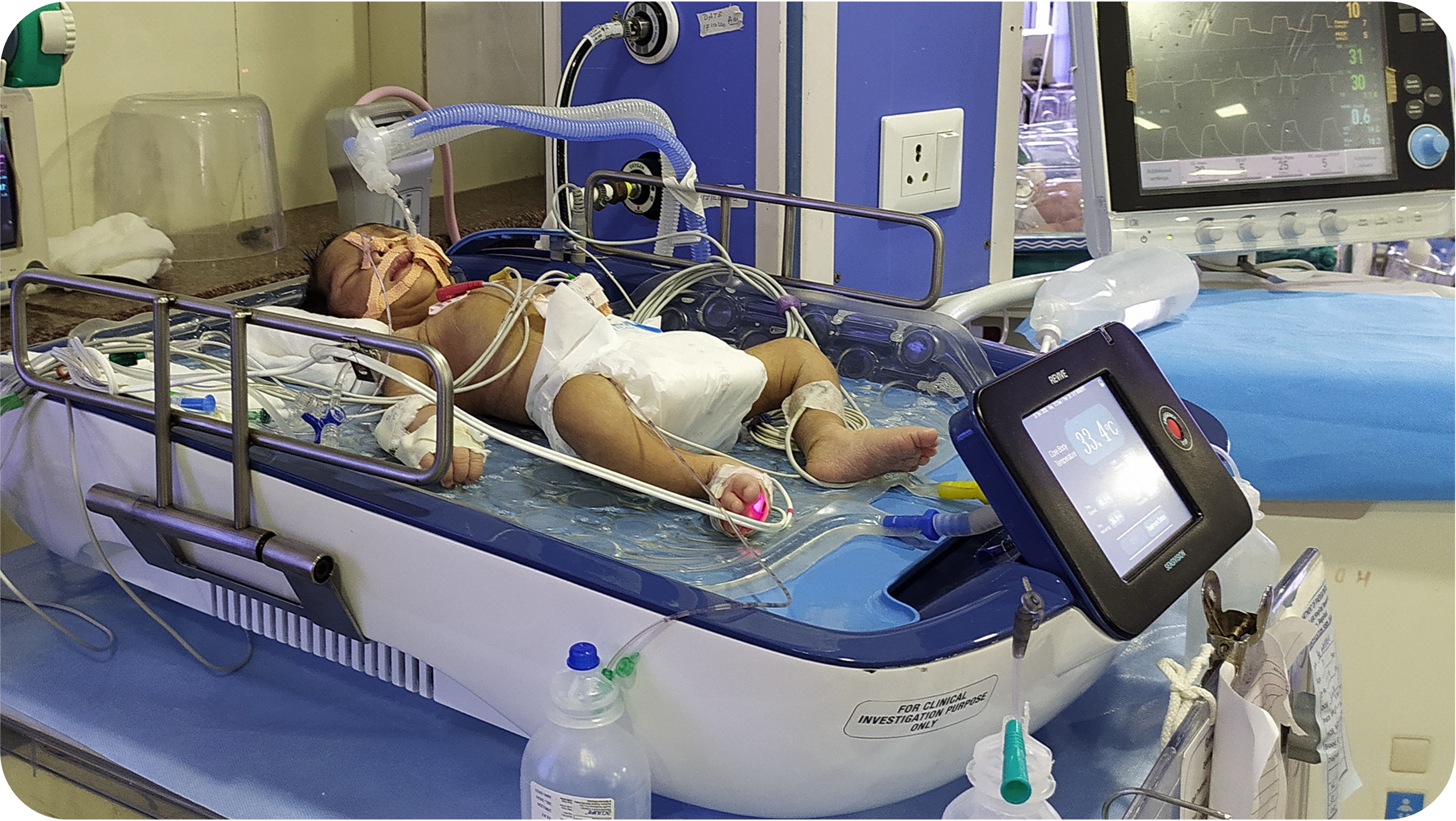 Hospital NICU setting showing newborn baby receiving whole body cooling therapy on blue REVIVE cooling blanket system, white and blue REVIVE control unit with black touchscreen display showing 92.4°C temperature reading, multiple monitoring sensors and cables connected to patient, professional hospital environment with medical equipment in background