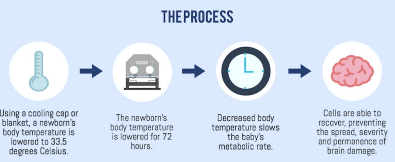 Therapeutic Hypothermia to the rescue of HIE-ridden patients ...